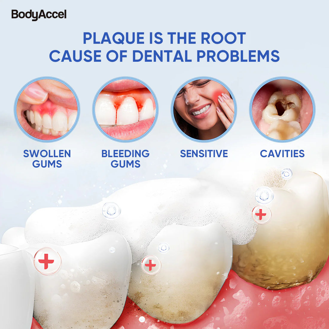Diagram showing dental issues caused by plaque with images of swollen gums, bleeding gums, sensitive teeth, and cavities.