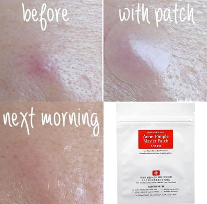 Cosrx Acne + Pimple Master Patches Pack .(24 Patches in one Pack).